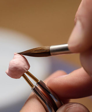 dental Kronen und Brücken uk