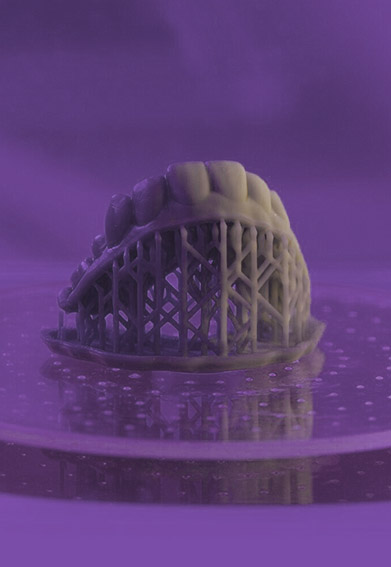 Cerameus Zahnschanner