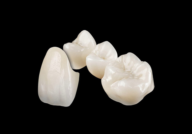 Zahntechnische Laborarbeit