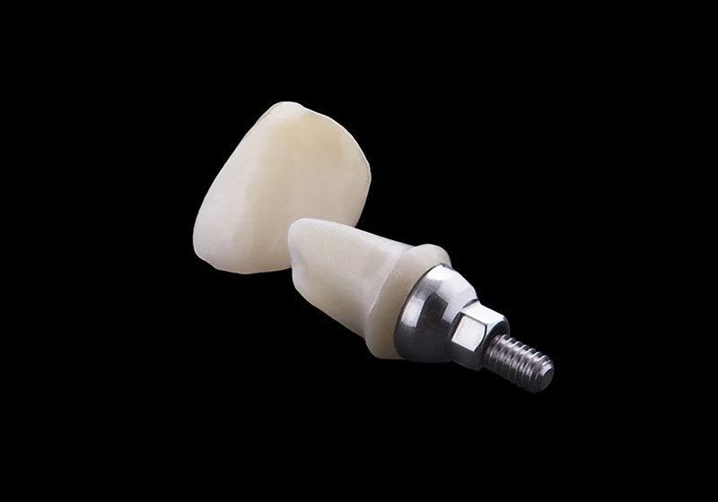 Zahntechnische Laborarbeit