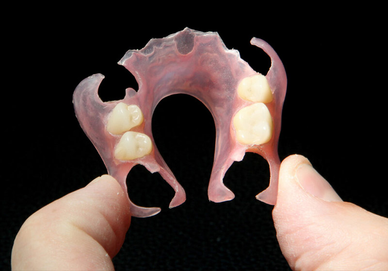 Zahntechnische Laborarbeit