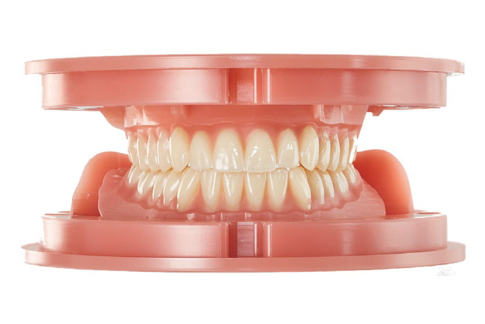 Digitaler  Zahnersatz