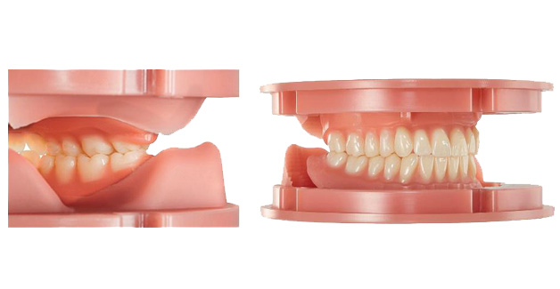 Digitaler Zahnersatz Posterior Teeth Design