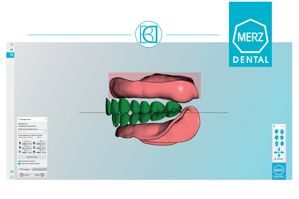 digital denture
