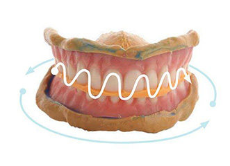 Digitaler Zahnersatz Scan the denture(s) inside out