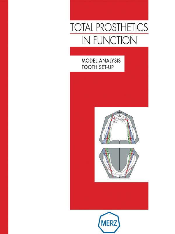 digitaler Zahnersatz
