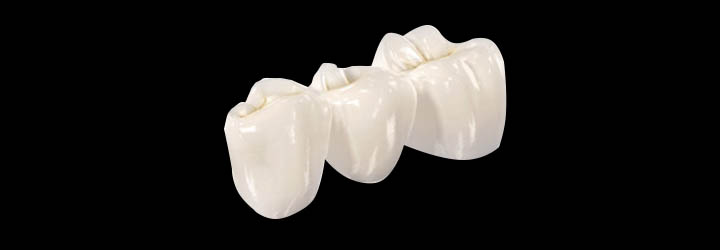 Cerameus layered zirconia crown-bridges