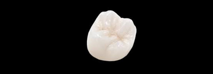 Cerameus full contour zirconia crown-bridges