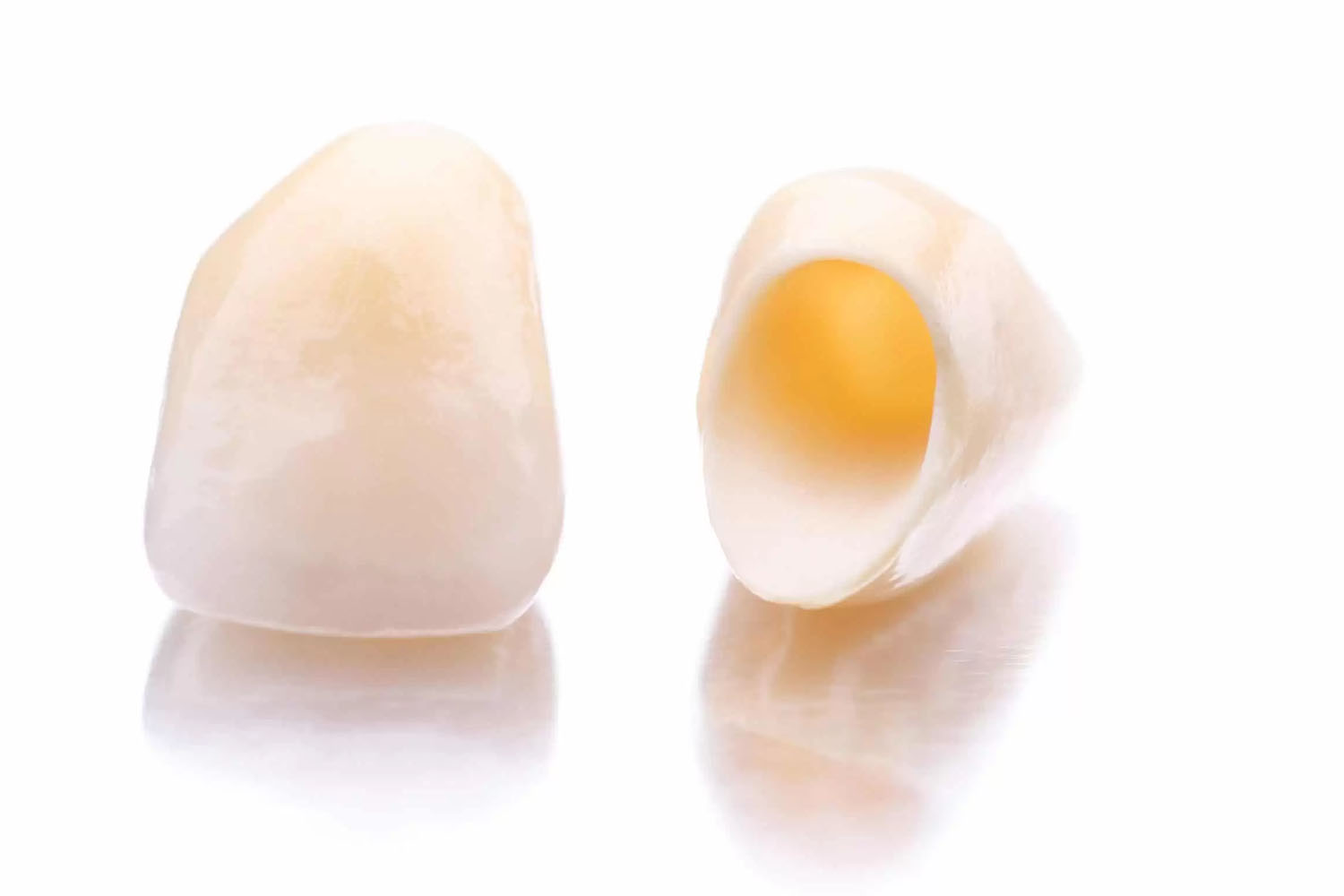 cerameus crown-bridges