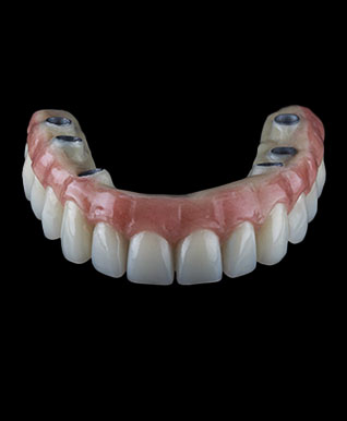 dental implants united kindom