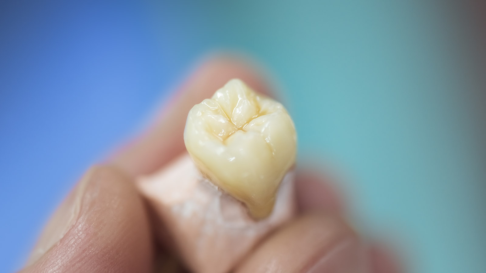 dental lab uk cervices