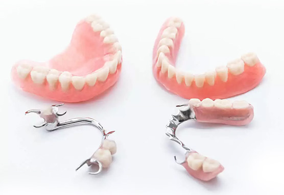 Cerameus denture lab uk