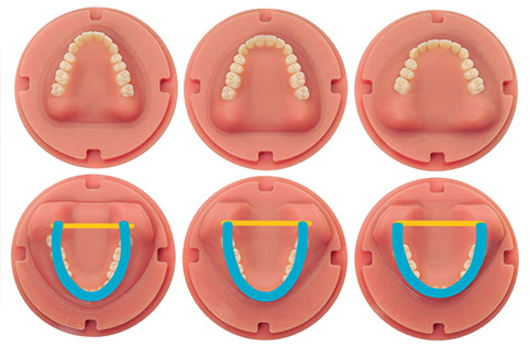 digital dentures Patient-Centric Solutions