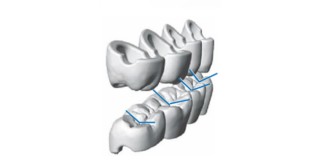 digital dentures Efficiency