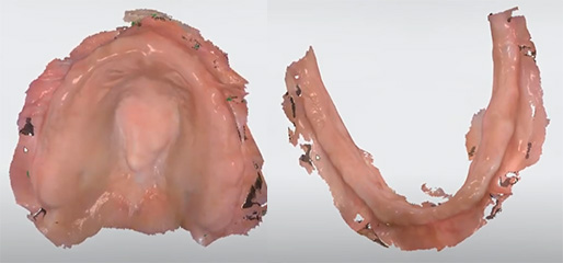 digital dentures anatomical details