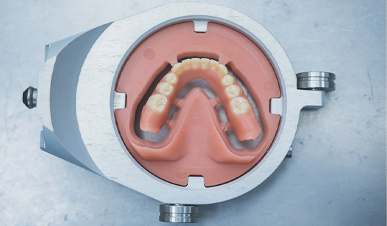 digital dentures Aesthetics and Durability